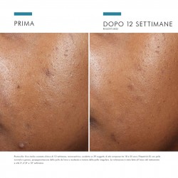 Skinceuticals Correct Phyto A+ Trattamento Correttivo 30 Ml - Trattamenti per pelle impura e a tendenza acneica - 983720588 -...